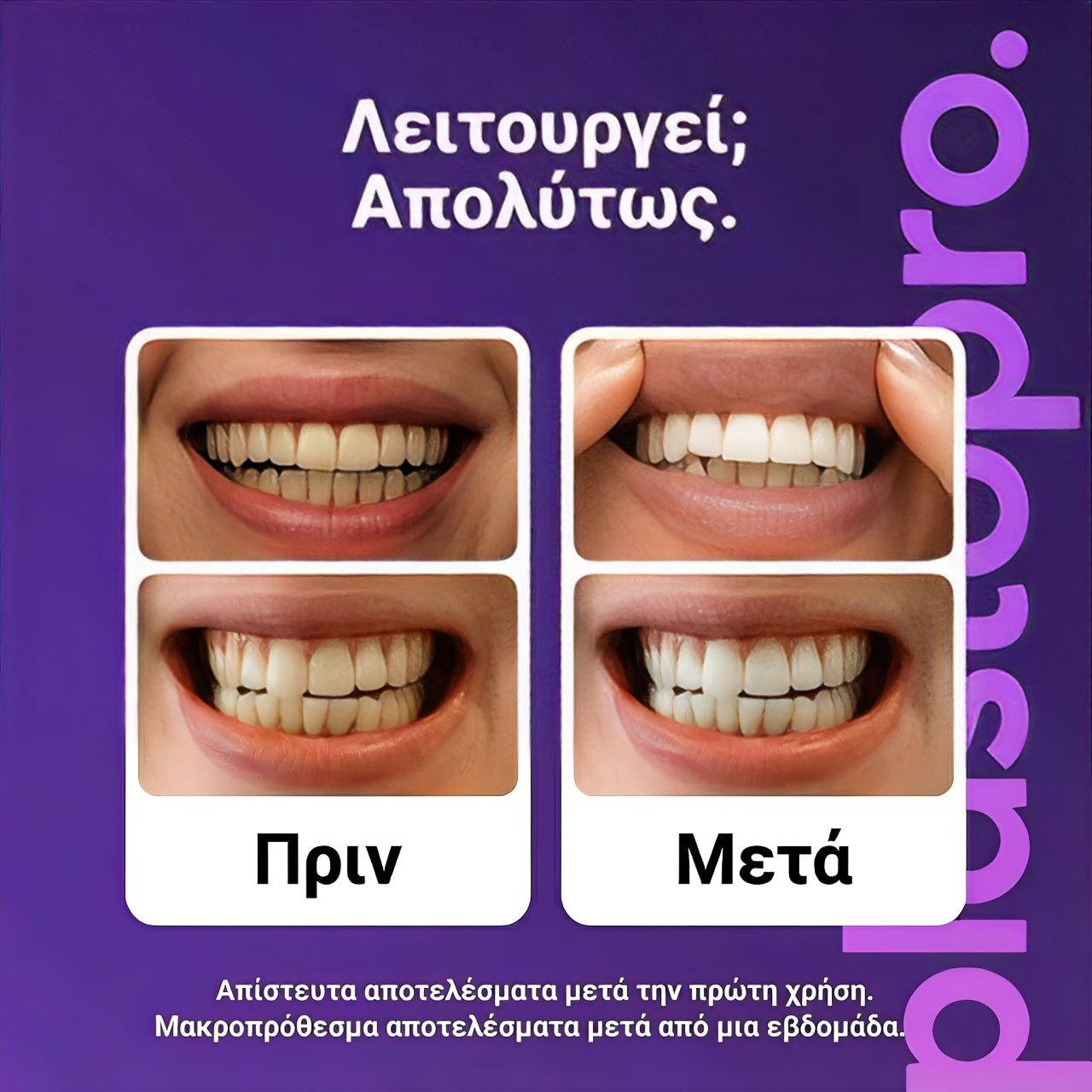 ΛΕΥΚΑΝΤΙΚΗ ΤΑΙΝΙΑ PLASTOPRO™ – 42 ΤΑΙΝΙΕΣ